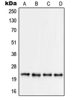 1 - Anti-RPS9 Antibody AP51492