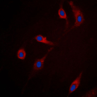 3 - Anti-RRAD Antibody AP51493
