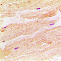 19 - Anti-RRAD Antibody AP51493