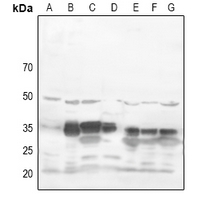 1 - Anti-RRAD Antibody AP51493