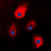 3 - Anti-S100-A1 Antibody AP51496