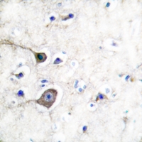 19 - Anti-S100-A1 Antibody AP51496