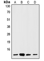 1 - Anti-S100-A1 Antibody AP51496