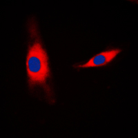 3 - Anti-Mammaglobin B Antibody AP51497