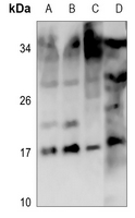 1 - Anti-Mammaglobin B Antibody AP51497