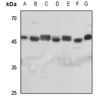 1 - Anti-Septin 7 Antibody AP51501