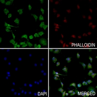 3 - Anti-Serpin A1 Antibody AP51502