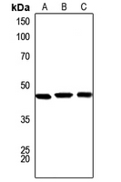 1 - Anti-Serpin A1 Antibody AP51502