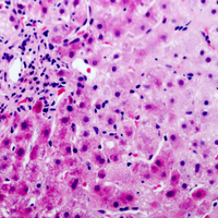 19 - Anti-PAI3 Antibody AP51503