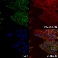 3 - Anti-Serpin B4 Antibody AP51504