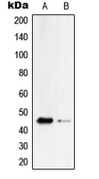 1 - Anti-Serpin B4 Antibody AP51504