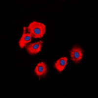 3 - Anti-Serpin B5 Antibody AP51505