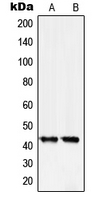 1 - Anti-Serpin B5 Antibody AP51505