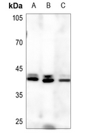 1 - Anti-Serpin B9 Antibody AP51506