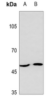 1 - Anti-MCT13 Antibody AP51512