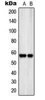 1 - Anti-SLC22A17 Antibody AP51513