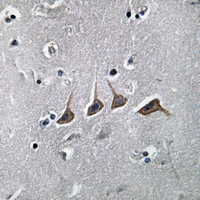 19 - Anti-PAHT Antibody AP51514