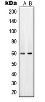 1 - Anti-PAHT Antibody AP51514