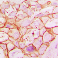 19 - Anti-ARALAR1 Antibody AP51515