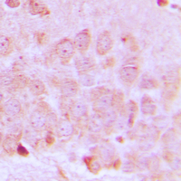 19 - Anti-ODC Antibody AP51516