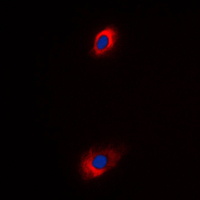 3 - Anti-ANT4 Antibody AP51517