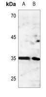 1 - Anti-ANT4 Antibody AP51517