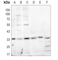0 - Anti-ANT4 Antibody AP51517
