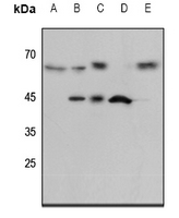 1 - Anti-ENT1 Antibody AP51518