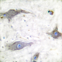 19 - Anti-GLUT1 Antibody AP51519