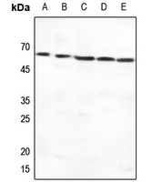 1 - Anti-GLUT1 Antibody AP51519