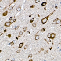 19 - Anti-GLUT3 Antibody AP51520