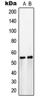 1 - Anti-GLUT3 Antibody AP51520