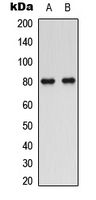1 - Anti-SMIT1 Antibody AP51521
