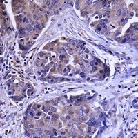 19 - Anti-SBAT1 Antibody AP51523
