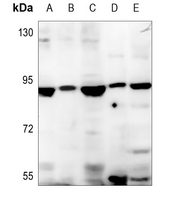 1 - Anti-SBAT1 Antibody AP51523