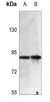 1 - Anti-SLC6A17 Antibody AP51524