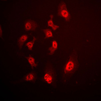 3 - Anti-SMAD4 Antibody AP51526