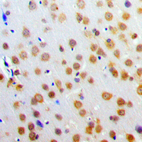 19 - Anti-SNAP25 Antibody AP51530