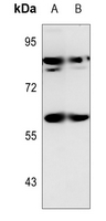1 - Anti-SNX1 Antibody AP51531