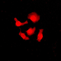 3 - Anti-SRSF3 Antibody AP51533