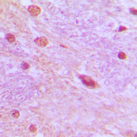 19 - Anti-SRSF3 Antibody AP51533