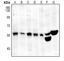 1 - Anti-SRSF4 Antibody AP51534