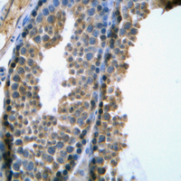 19 - Anti-SRY Antibody AP51535