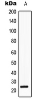 1 - Anti-SRY Antibody AP51535