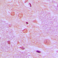 19 - Anti-SYT Antibody AP51536