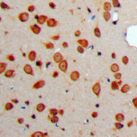 19 - Anti-Somatostatin Antibody AP51537