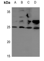 1 - Anti-STMN2 Antibody AP51541