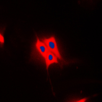 3 - Anti-AS160 (Phospho-T642) Antibody AP51548