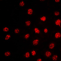 3 - Anti-TBX15/18 Antibody AP51549