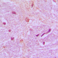 19 - Anti-TBX15/18 Antibody AP51549